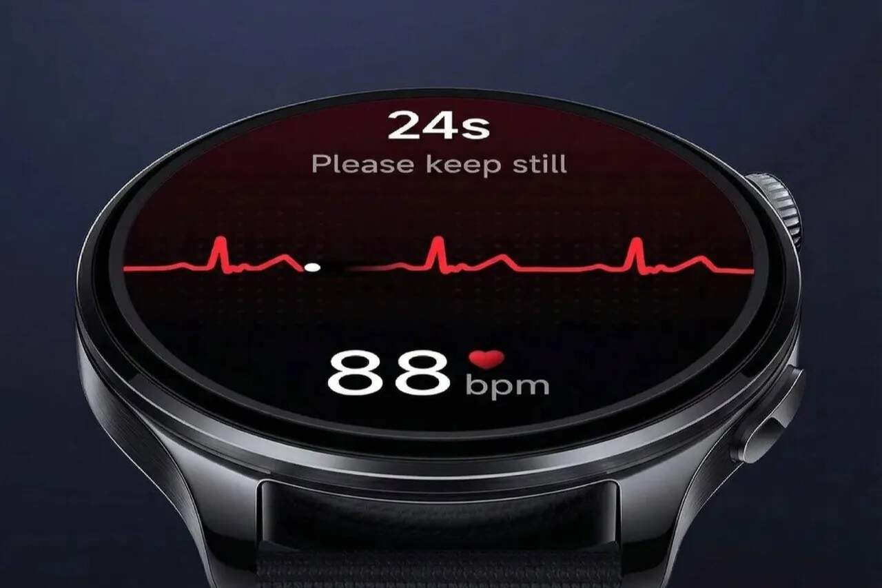Xiaomi Watch 5 พลิกโฉมสมาร์ทวอทช์! ใส่เซนเซอร์ EMG ครั้งแรกของโลก