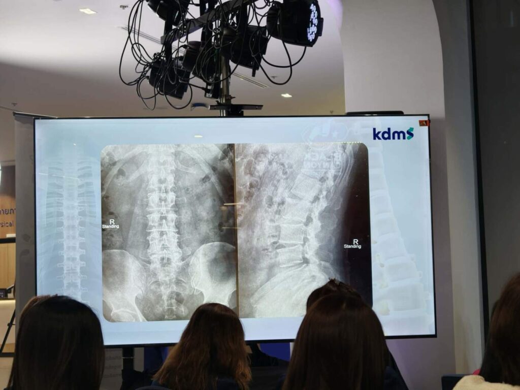 kdms ยกระดับสู่ Center of Excellence ผ่าตัดกระดูกสันหลังผ่านกล้อง ตอบโจทย์สังคมสูงวัยและคนทำงาน