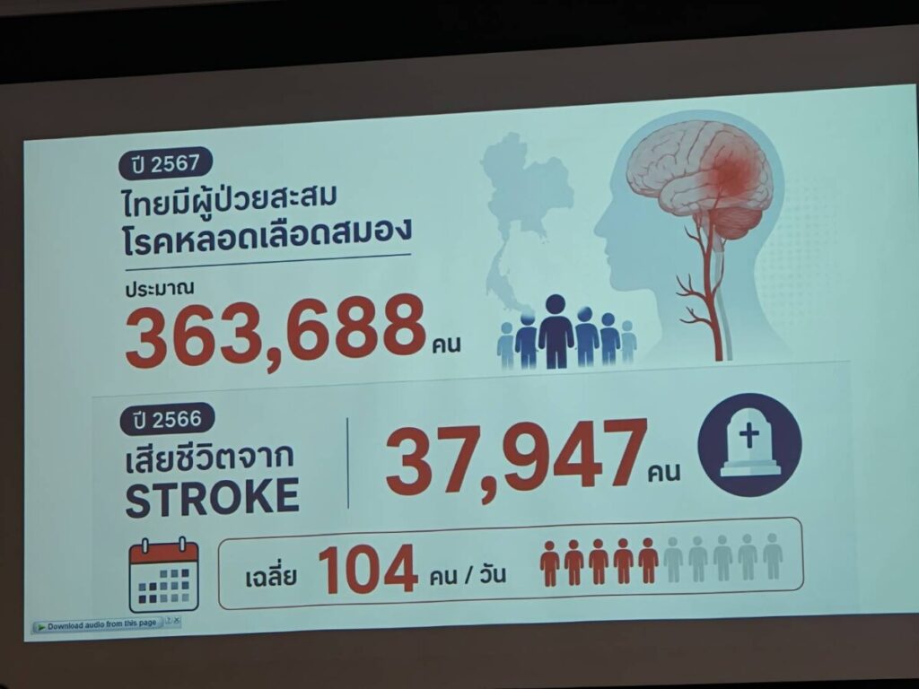 “Stroke” ภัยเงียบเปลี่ยนชีวิต ชี้ “หัวใจเต้นพลิ้ว AF” สาเหตุใหญ่ที่มักถูกละเลย แพทย์แนะตรวจเช็กเชิงรุกคู่ความดันโลหิต